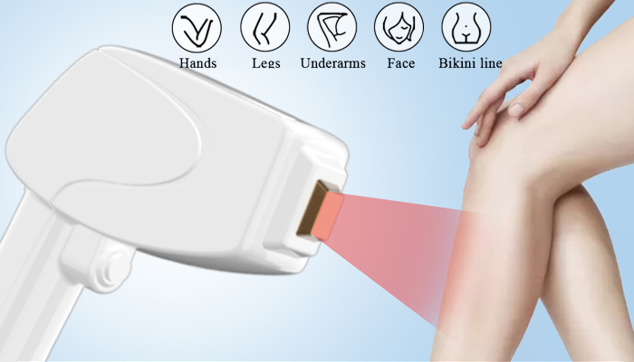 Triple Wavelength Diode Laser Hair Removal - Manufacturer