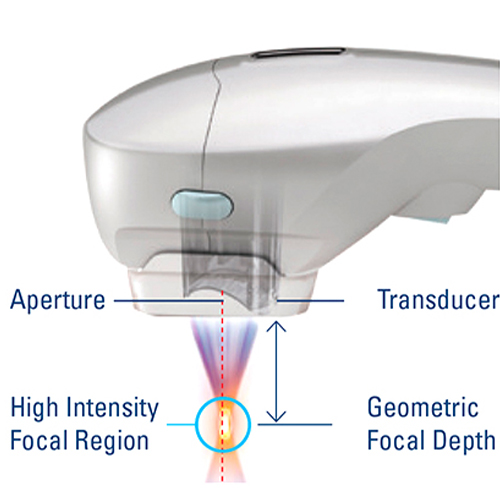 Transducer