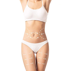 velashape body contouring