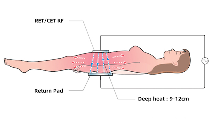 Tecar Therapy Technology