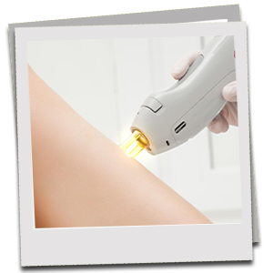 Professional Handle Specially designed for dermatologists