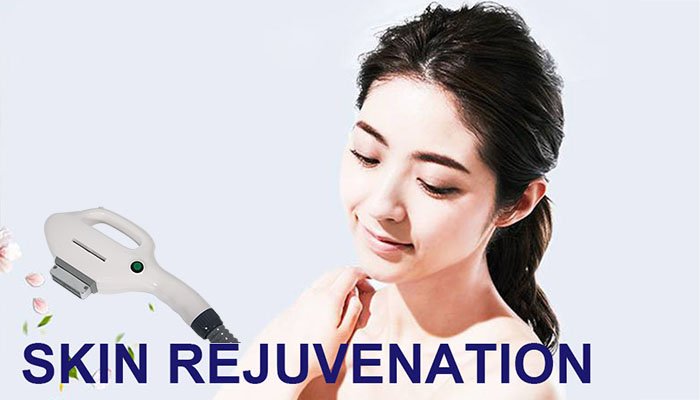 IPL Skin Rejuvenation