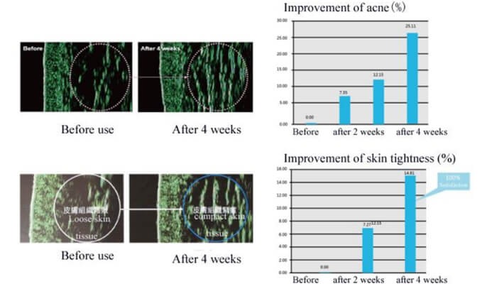 The Plasma energy makes aging cells atrophy and recombines by sputtering