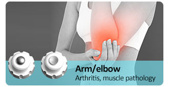Arm/elbow
