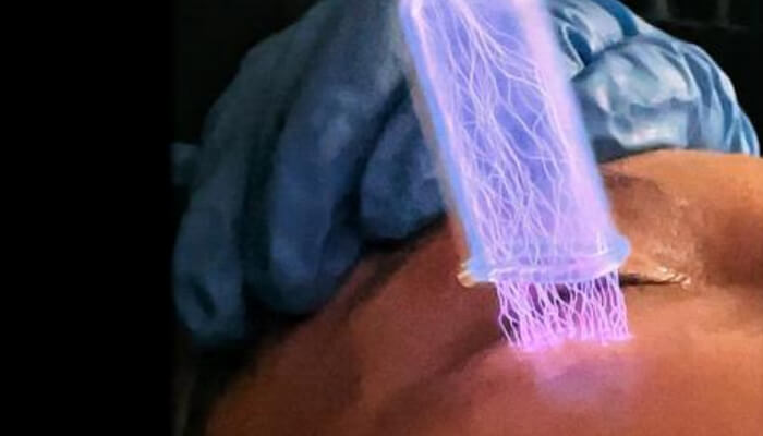 Fusion Plasma Working Principle