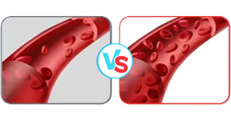 Improved Blood Supply