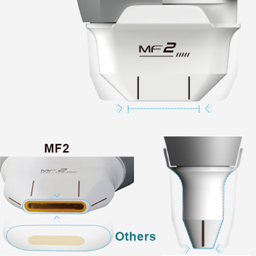 Patent 2.0 mm Cartridge - MF2
