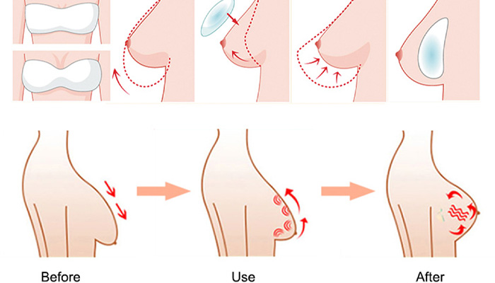 Professional Breast Care Machine Working Principle