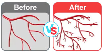 Vascular Regeneration