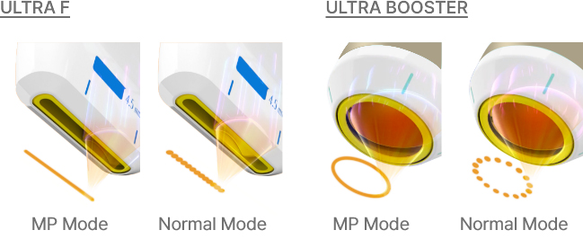 MP & normal mode