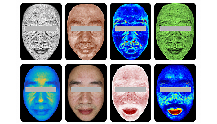 Real Skin Case Display for Faster and More Professional Analysis Real Skin Case Display for Faster and More Professional Analysis