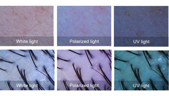 Microscopic imaging of skin details presentation Microscopic imaging of skin details presentation