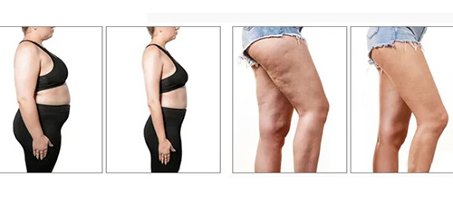 Red Light Therapy Before and After Red Light Therapy Before and After